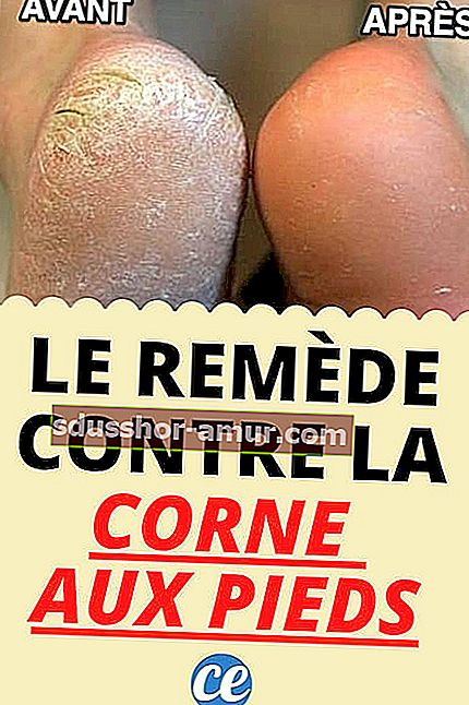 Corne aux Pieds: Рецепт бабушки, идущей у огня божьего!