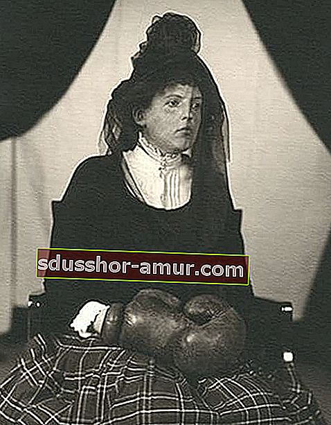 Жена, седнала на стол, оборудван с боксови ръкавици 