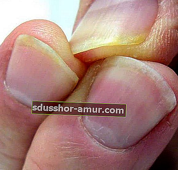Отстранете следите от никотин от пръстите на пушачите с паста за зъби
