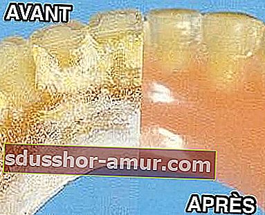 Zobne proteze pred in po čiščenju bikarbonata 