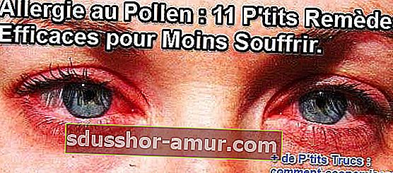 Ochii roșii din cauza alergiilor la polen