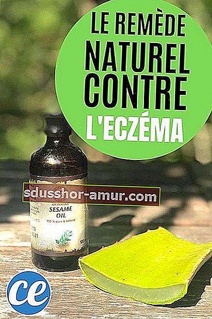 Aloe vera și uleiul de susan ca remediu natural pentru calmarea eczemelor