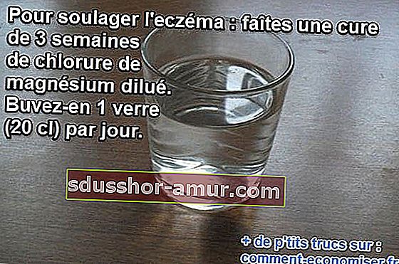 magnezijev klorid razrijeđen u čaši vode prirodni je lijek za ublažavanje ekcema