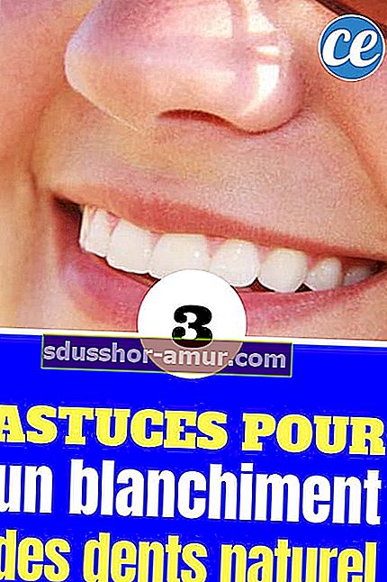 3 поради щодо білих зубів