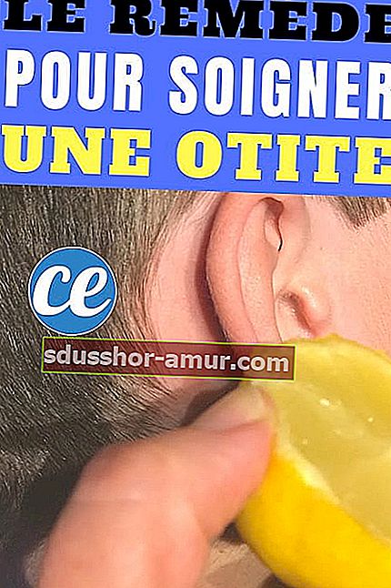 Limun je lijek za liječenje upale uha