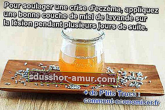 средство за облекчаване на екзема криза мед лавандула