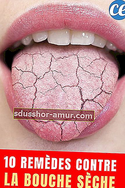 Usta izbliza koja vire suhi jezik s tekstom: 10 lijekova za suha usta