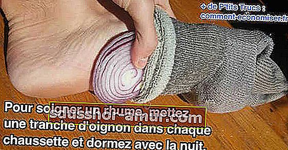 Stavite krišku luka u čarape kako biste izliječili prehladu